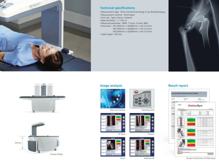 골밀도 DEXA (이중에너지 방사선흡수계측)